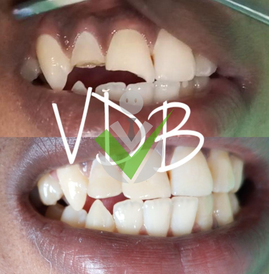 Votre dentiste à Bertoua